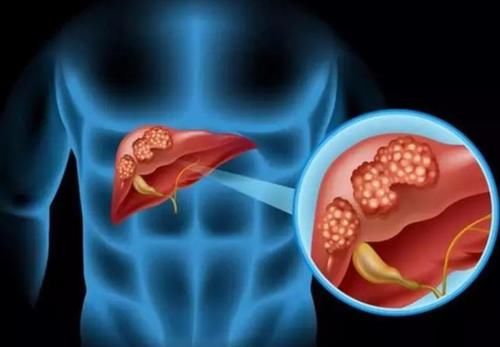 木耳|经常吃馒头会伤肝吗?提醒:想要养肝的人,这四种素食尽早远离