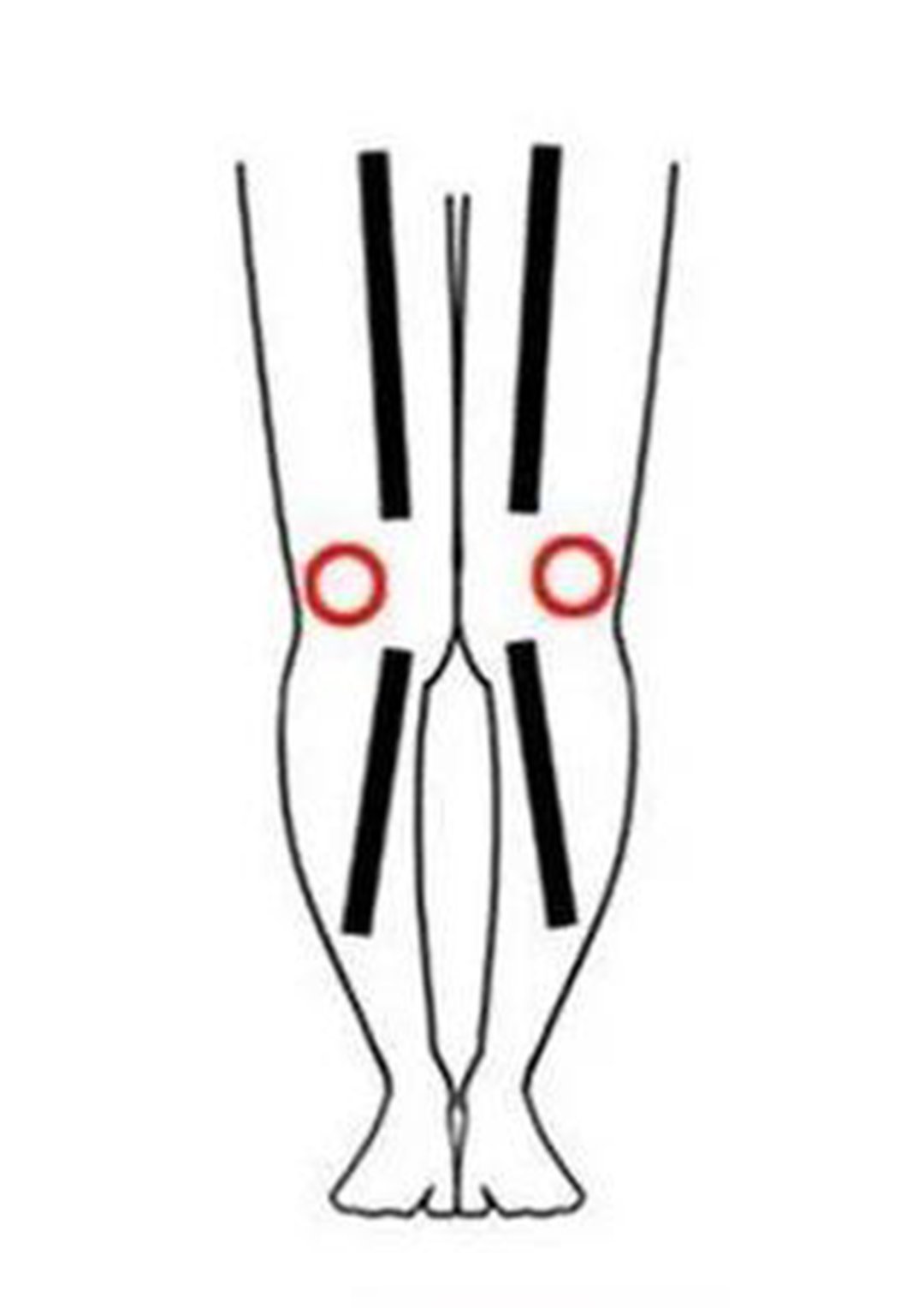 腿形|不同腿型的女孩，如何挑到适合自己的裤子？