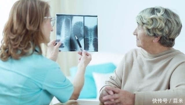 信号|“宫颈癌”来临前，身体一般会发出3个“信号”！