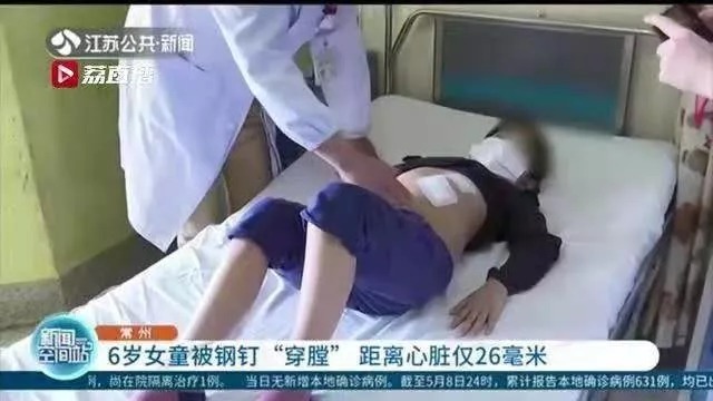 哨子|wenno:6岁男孩吞哨子,瞒了20年后肺部…不敢和父母说,是最危险的育儿信号