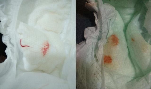 妈妈|“妹妹流血啦,妈妈快来”,面对意外,哥哥的反应让医生竖起拇指