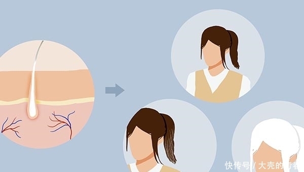 容易长白发的人,不会轻易得癌?有科学依据吗?医生告诉你答案