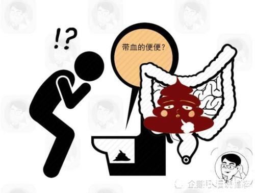 肠癌|常便秘的人若排便伴有2个症状,需当心,这或是肠癌在“搞事情”