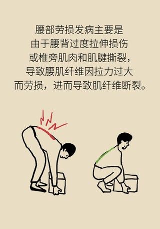腰肌劳损|年纪轻轻也没干啥体力活儿,怎么就腰肌劳损了?