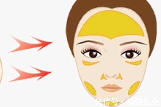 攻略 面部填充脂肪多长时间能恢复自然状态?价格&术后攻略送你参考!