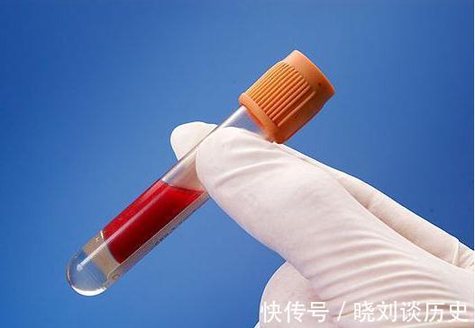 胆固醇|降血脂的妙招找到啦!2物多吃3事少做,血脂慢慢就会降下来啦