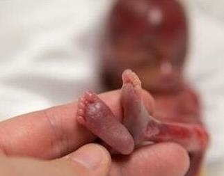 结果|每年因各种原因流掉的胎儿，最后都怎样了？知道结果让人心痛