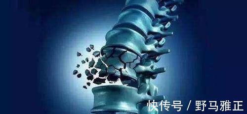 日本广岛大学|三甲院士：多喝这种水缓解骨质疏松，比牛奶强，别再忽视腰酸背疼