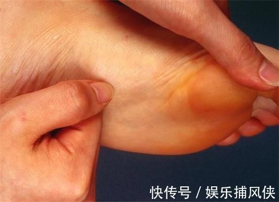 视力|“糖尿病”多是拖出来的,身体“3处”出现反常,可能血糖已高!