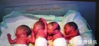 济南第二医院|32岁孕妇舍命生五胞胎,最小的仅鸡蛋一般大,令人揪心的纪录片!