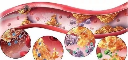 温阳|88岁国医,血管光滑无斑块!他坚持30年的养生二宝,值得借鉴!