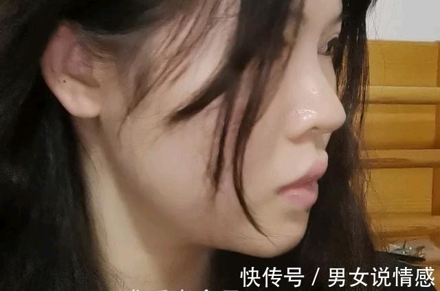 唇部 做什么医美改善凸嘴效果最快!