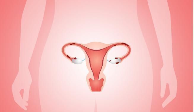 血块|女人若有5种表现，提示子宫不好！一个不占，值得恭喜