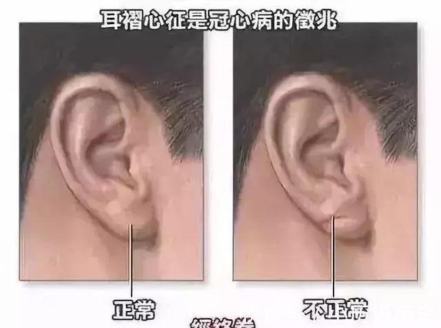 端粒体|长不长寿,“脸”知道?进来看看你是不是长寿脸