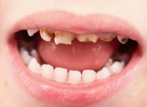 耗油|别只盯着盐和糖，这些调料也“危险”！常给孩子吃，容易脾虚个矮