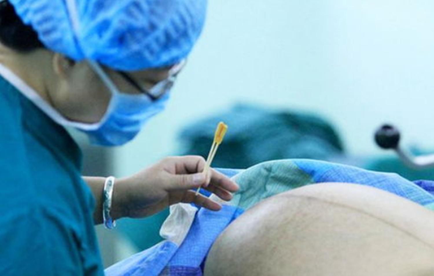 宁愿肚子上留疤，也不愿意顺产，女明星为什么会如此钟爱剖腹产