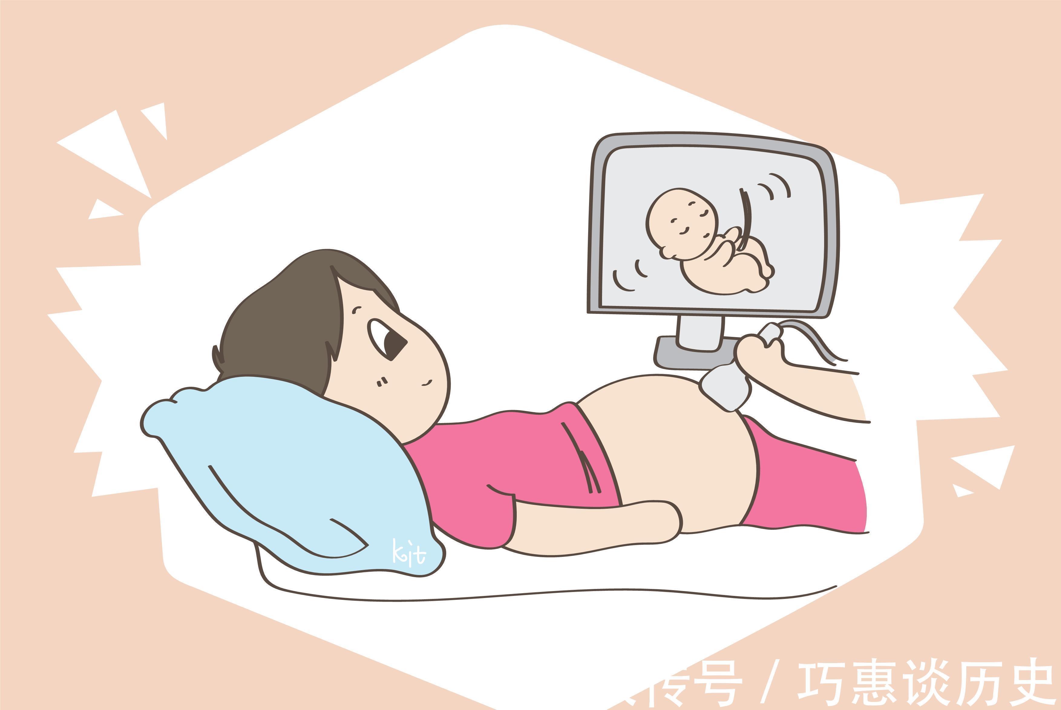 孕妇|孕后体检时间并非人人一样,遇到这些情况,需要提前孕检