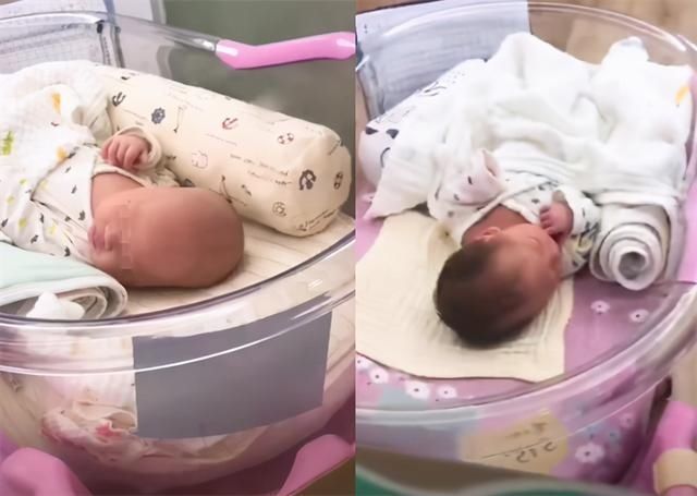 新生儿头发稀少只因遗传?做好这5点宝宝头发浓又密,赶紧学起来