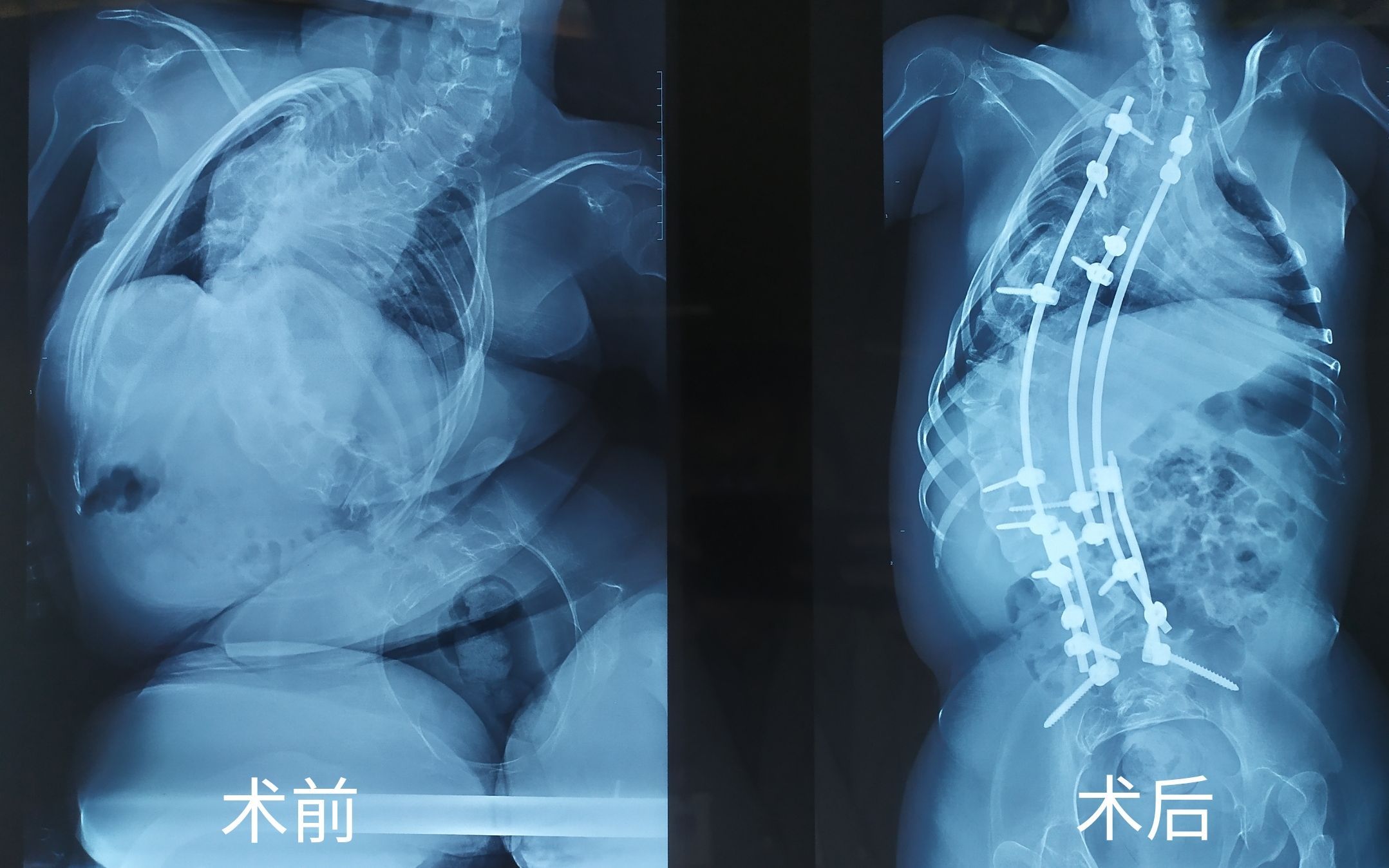 门诊|他们组建联合门诊，为罕见病患儿“拓宽”生命