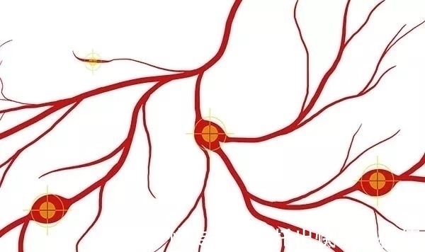 心脑血管|血管的“清洗剂”找到了,几块钱的食物,经常吃点,降脂清血管