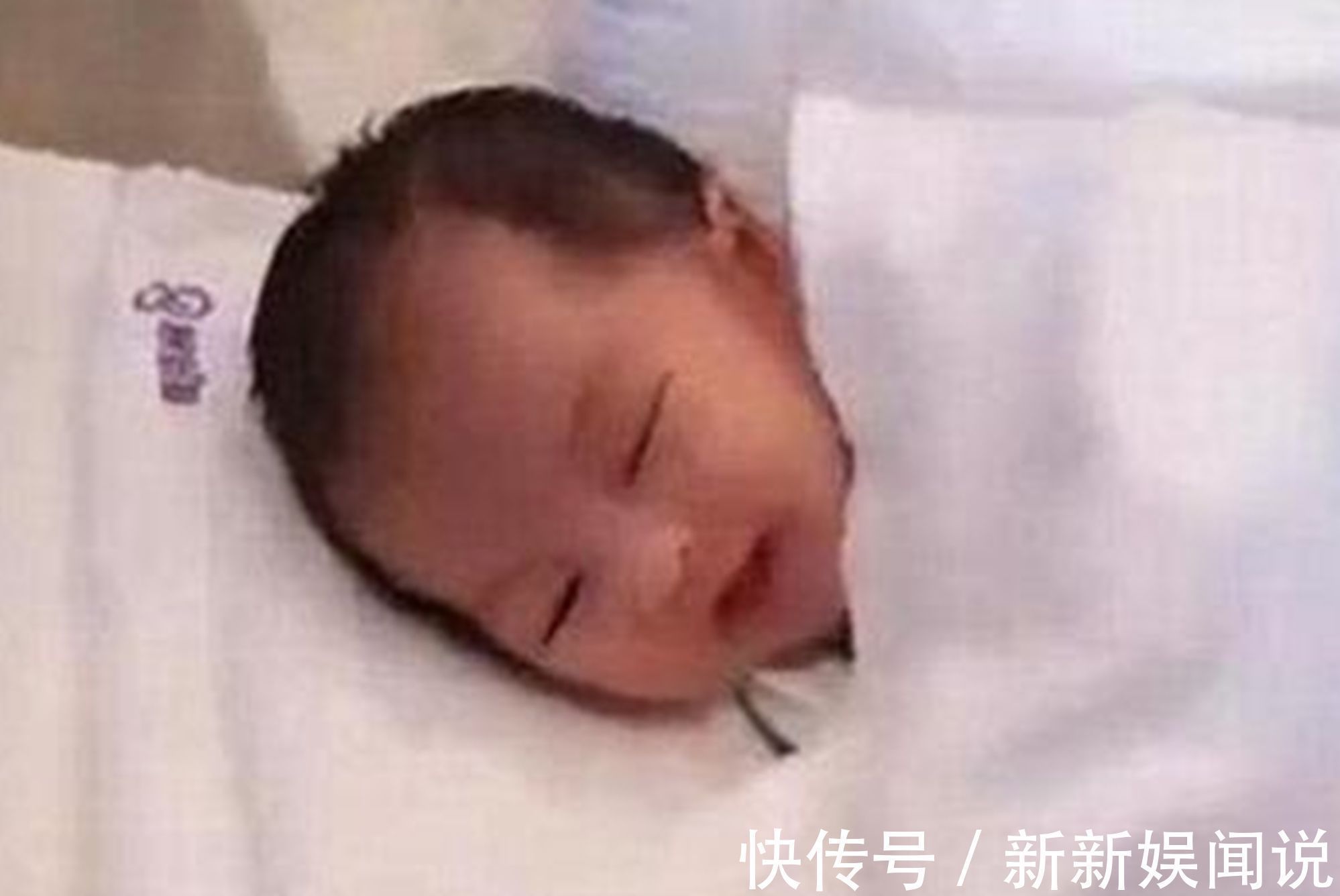 维娘胎里“整容”是什么体验?医生:孕期注意,你的孩子也不会丑