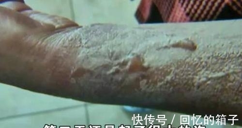 电水壶|杭州女子网购电水壶，被烫伤后索赔3000元，网友们却并不“同情”