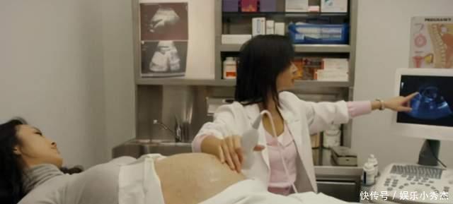 孕妇|孕妇产检被告知是“连体畸形儿”,顿时紧张大哭,医生看了却笑了