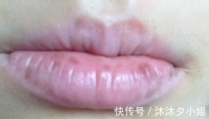 黑眼圈|子宫好的女人, 脸上可能有这4个现象? 你若占1个, 子宫还很健康