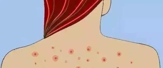 你怎么都戒不掉的“新型毒品”,除了发胖,还在让你越来越丑