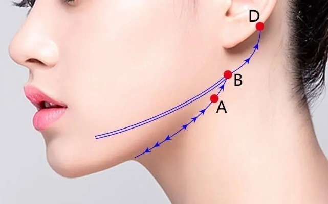 埋线|埋线提升不仅能让你年轻10岁，还能让你即刻拥有小V脸！