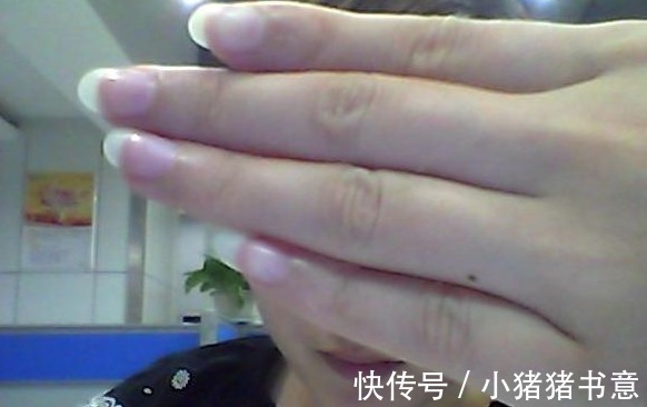 黑痣|手上若看见这个“玩意”或许是癌细胞苏醒的“前兆”最好别忽视