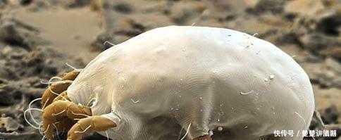 毛孔|只需一个小方法,脸上再也没螨虫,快回家除螨吧!