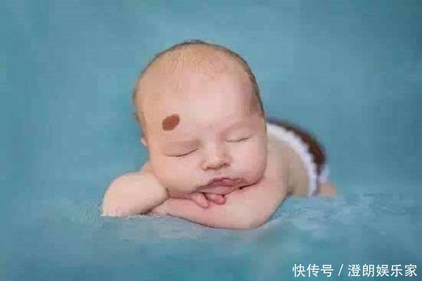 小静|孕妇在孕期这两个事情要注意,会让胎儿长胎记,很多孕妇忽略了