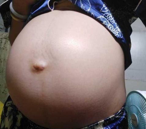 孕妈妈们|“都让你别躺着,胎儿缺氧还不上心”胎儿缺氧受什么影响