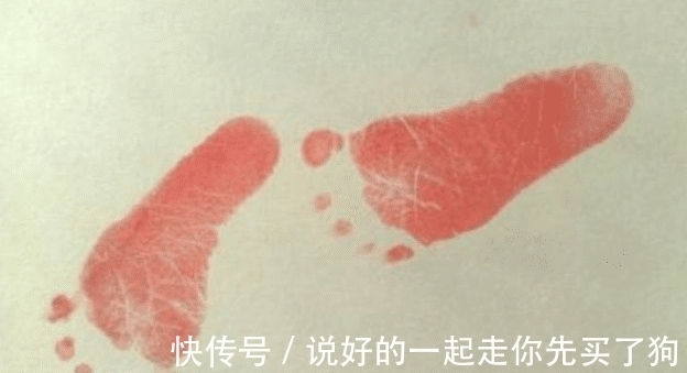 医生|新生儿出生后为什么要留脚印?医生没告诉,但家长也要知道