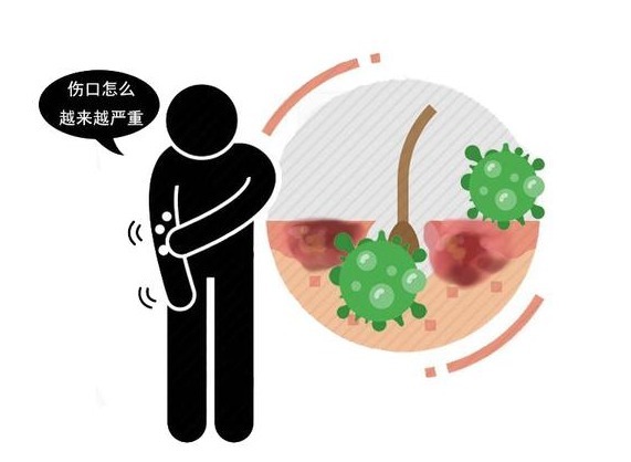 升高|血糖失控,皮肤告知!皮肤出现3种迹象,提示你该控糖了!