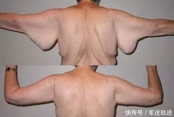 女子|女子体重过重决心减肥,瘦下来的她,看起来还不如不减