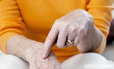 六十不到老年斑就开始“泛滥”,改掉三个坏习惯,皮肤越来越干净