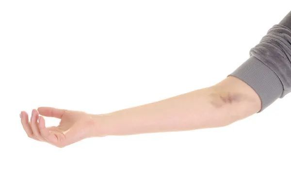 黑痣|皮肤有4个不起眼变化，当心癌盯上你！尤其最后1个，洗澡多看一眼就能发现