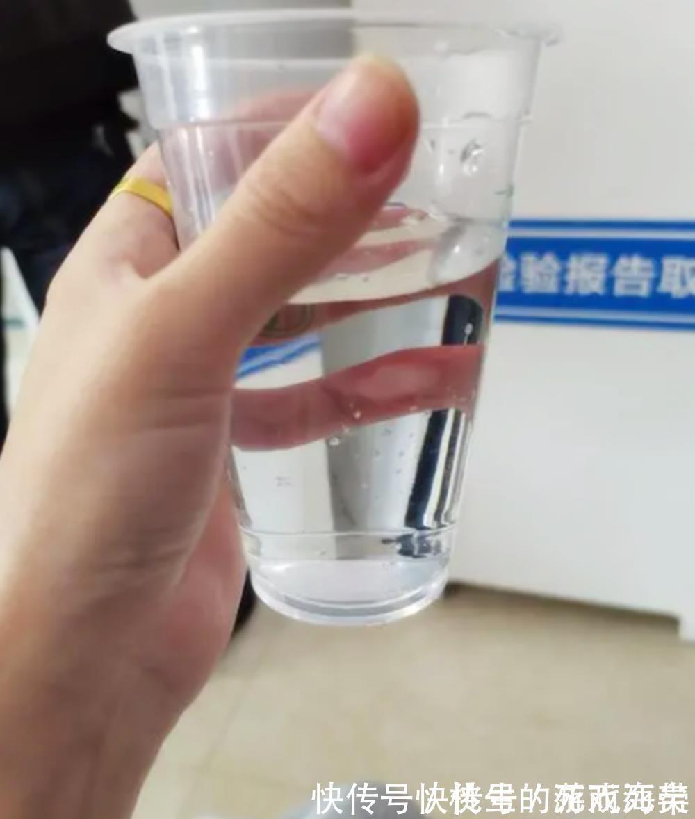 检查|孕期要做的众多检查中,一项最贵,一项最难受,还有一项最没用