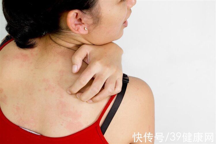 脂褐质|体内有癌,皮肤会通风报信,尽早察觉4个奇怪异样,别拖延