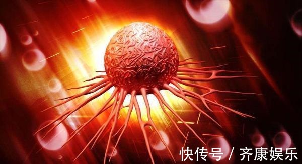 病情|胃癌患者,除了治疗,这5个措施也要重视,才能事半功倍