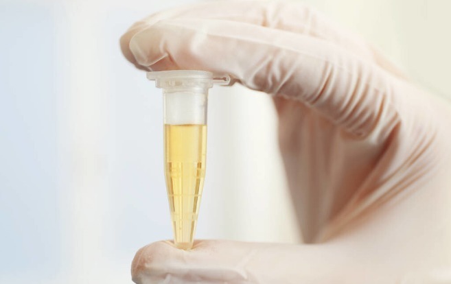 血糖监测|血糖高不高,小便就知道!排尿出现3种“异常”,可能是糖尿病