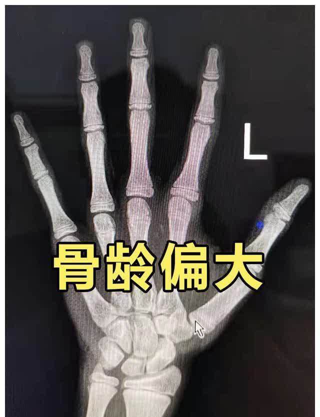 身高处|最新儿童标准身高表,你家孩子达标了吗?3大误区家长别大意