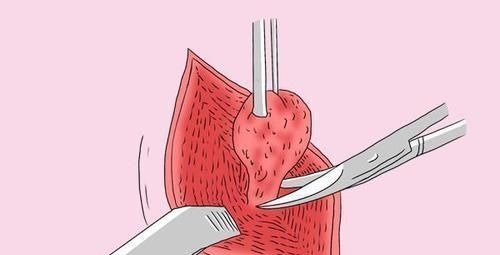 肿瘤患者|肿瘤患者,能满足3个条件,值得恭喜,治疗效果还不错