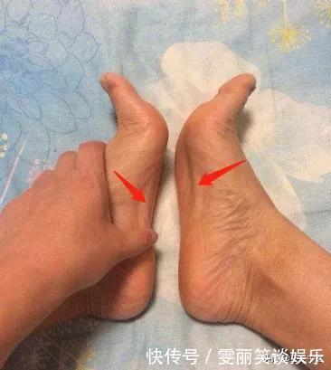 痰湿|大夫亲授的这个动作,让你不节食还能瘦,祛湿健脾的效果还好