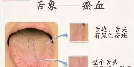  果你|免疫力是长寿关键，到底该如何加强自己免疫力？你的舌头知道答案