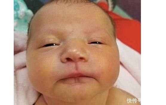 亲吻|亲吻小宝宝要小心,否则会给宝宝带来细菌!