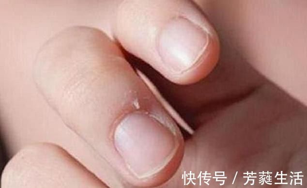 孩子|孩子是不是缺锌,身上会有4个明显变化,家长们可不要疏忽了