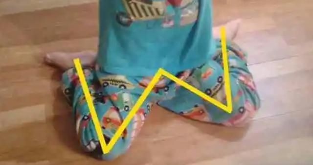 父母|8岁男孩脊椎侧弯,只因家人常做这个动作,这个错误,90%的父母都在犯